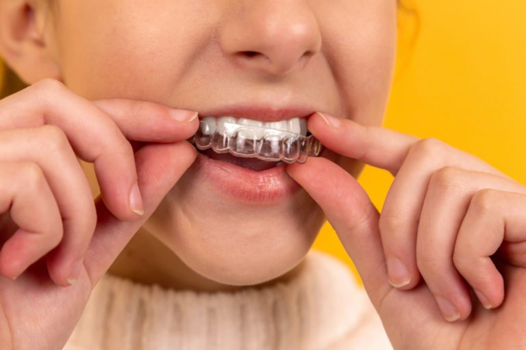 Choosing the Right Orthodontist for Your Kids